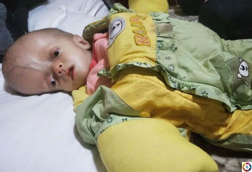 青海男子年近不惑喜得千金，數月后孩子頭部異常引關注，嬰幼兒臨時看護問題凸顯